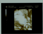 Baby 27+4 mit Hand am Kinn-klein.jpg (6113 Byte)