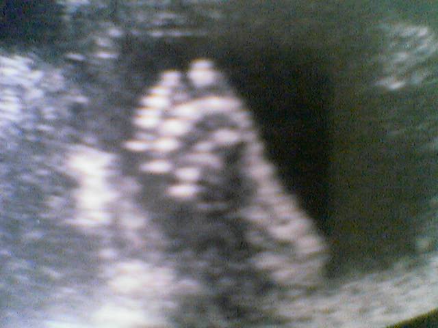 Fu� rechts.jpg (32228 Byte)