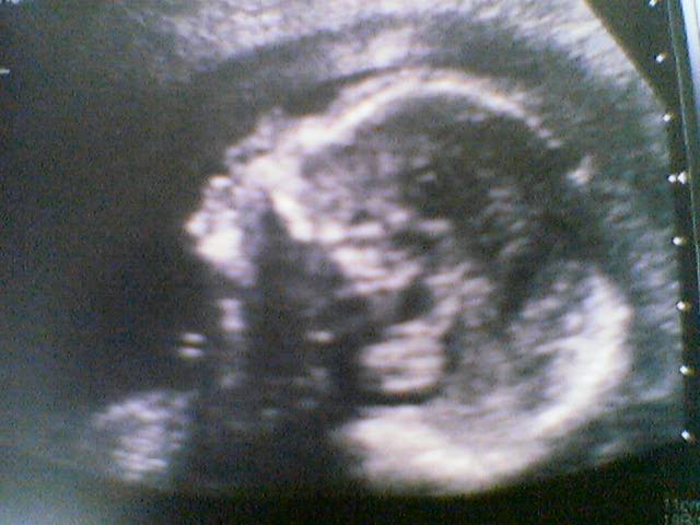 K�pfchen.jpg (34747 Byte)